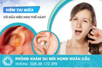 Nhận biết viêm tai giữa qua 6 dấu hiệu điển hình