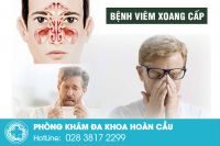 Viêm xoang cấp bệnh lý tai mũi họng nguy hiểm