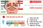 Viêm xoang cấp: bệnh lý không nên phớt lờ