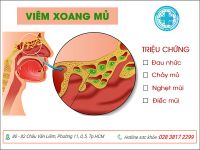 Cảnh giác với bệnh viêm xoang mủ hay gặp ở nhiều người