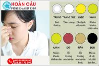 Cách điều trị viêm xoang mủ xanh nhanh chóng tại phòng khám Hoàn Cầu