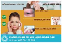 Bệnh viêm xoang sàng và những dấu hiệu nhận biết