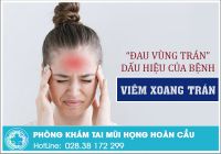 Vạch trần căn bệnh gây ra triệu chứng đau vùng trán