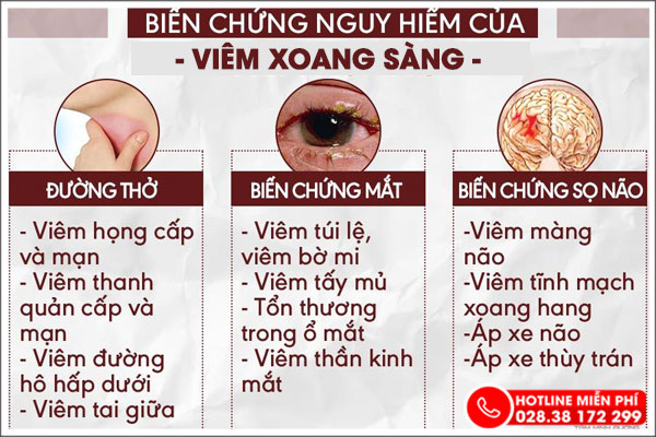 Những biến chứng nguy hiểm của viêm xoang sàng ít ai ngờ tới